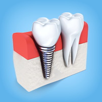 Smile Dent &mdash; стоматологическая клиника